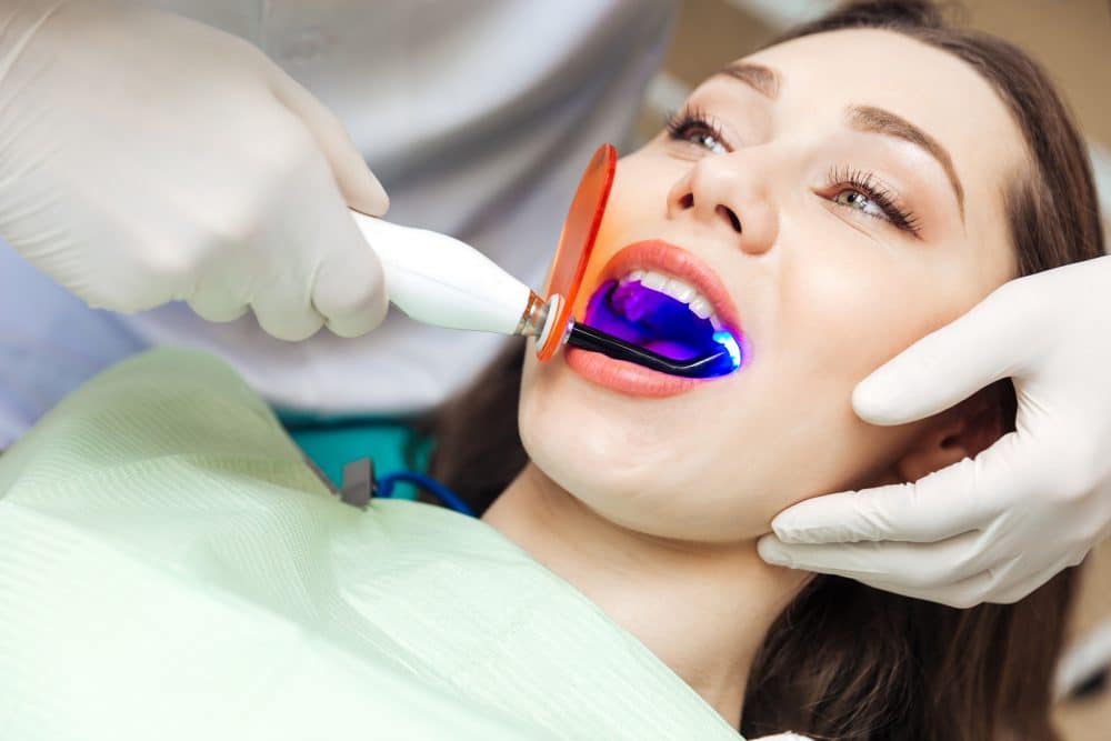 Laser Fillings